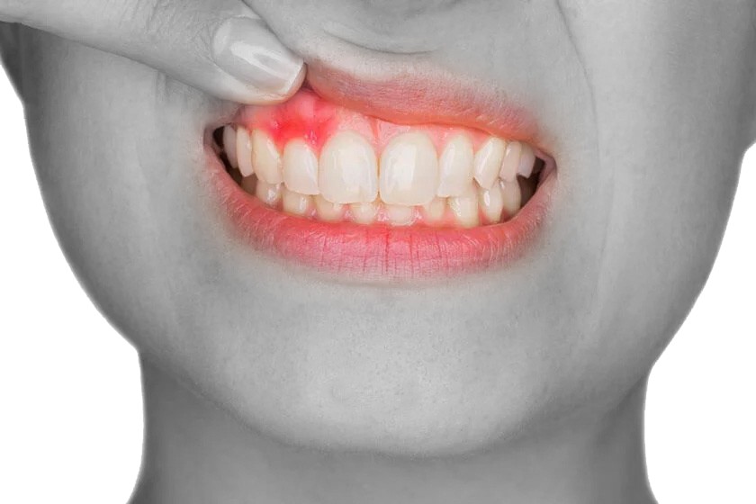 Periodontology in Whitefield, Bangalore: Your Guide to Healthy Gums