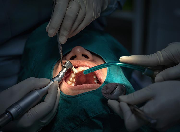 Beyond Extractions: Exploring the Spectrum of Oral Surgery Procedures