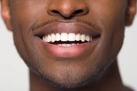 Orthodontics Uncovered: How Straightening Your Teeth Transforms Your Whole Health