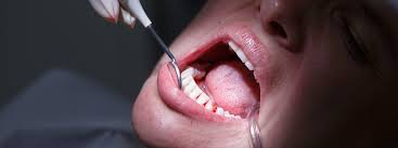 Periodontology: Saving Your Teeth From Gum Disease
